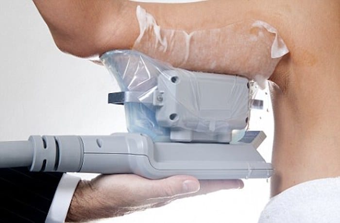 fat freezing arms Gloucester