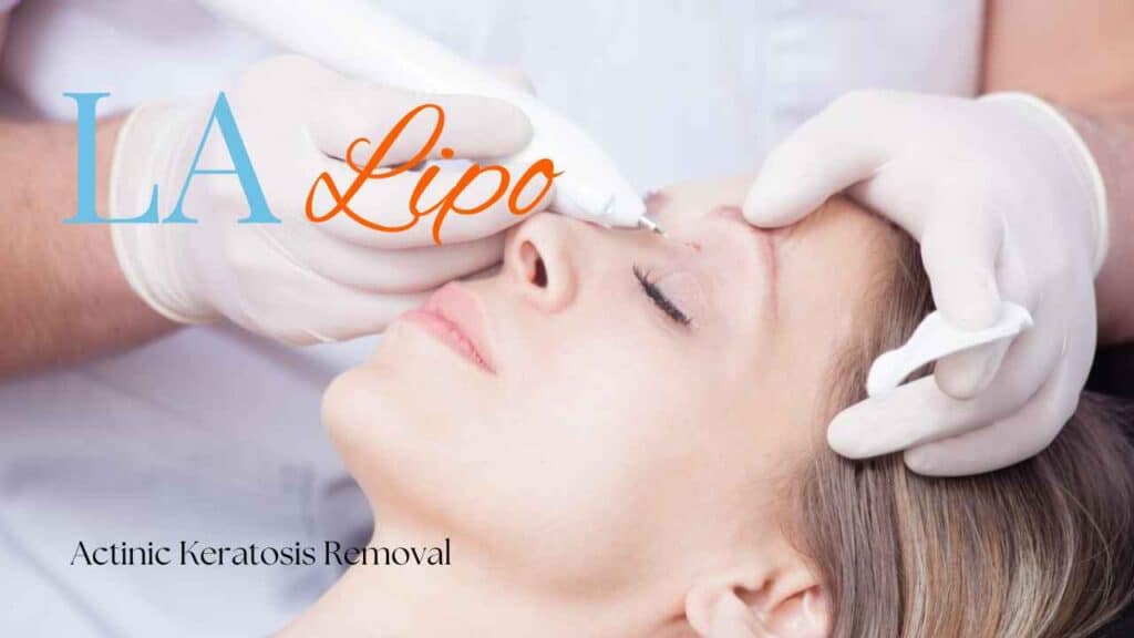actinic keratosis removal Gloucester
