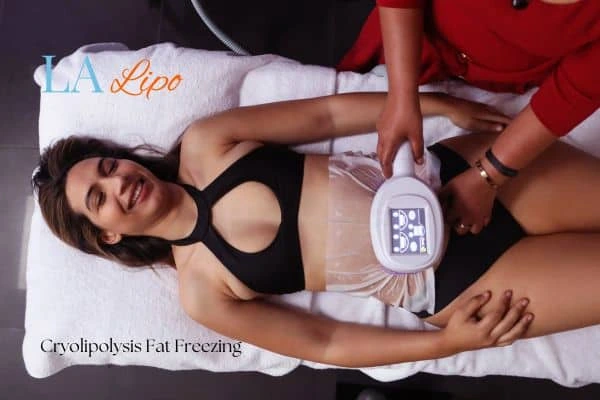 woman getting cryolipolysis Gloucester