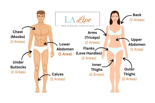 LA LIPO Cryolipolysis Areas Gloucester