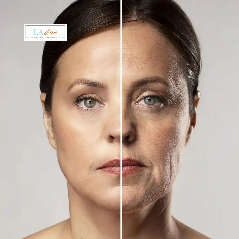 How Can You Tell If Non-Surgical Skin Tightening Is Right for You Gloucester?