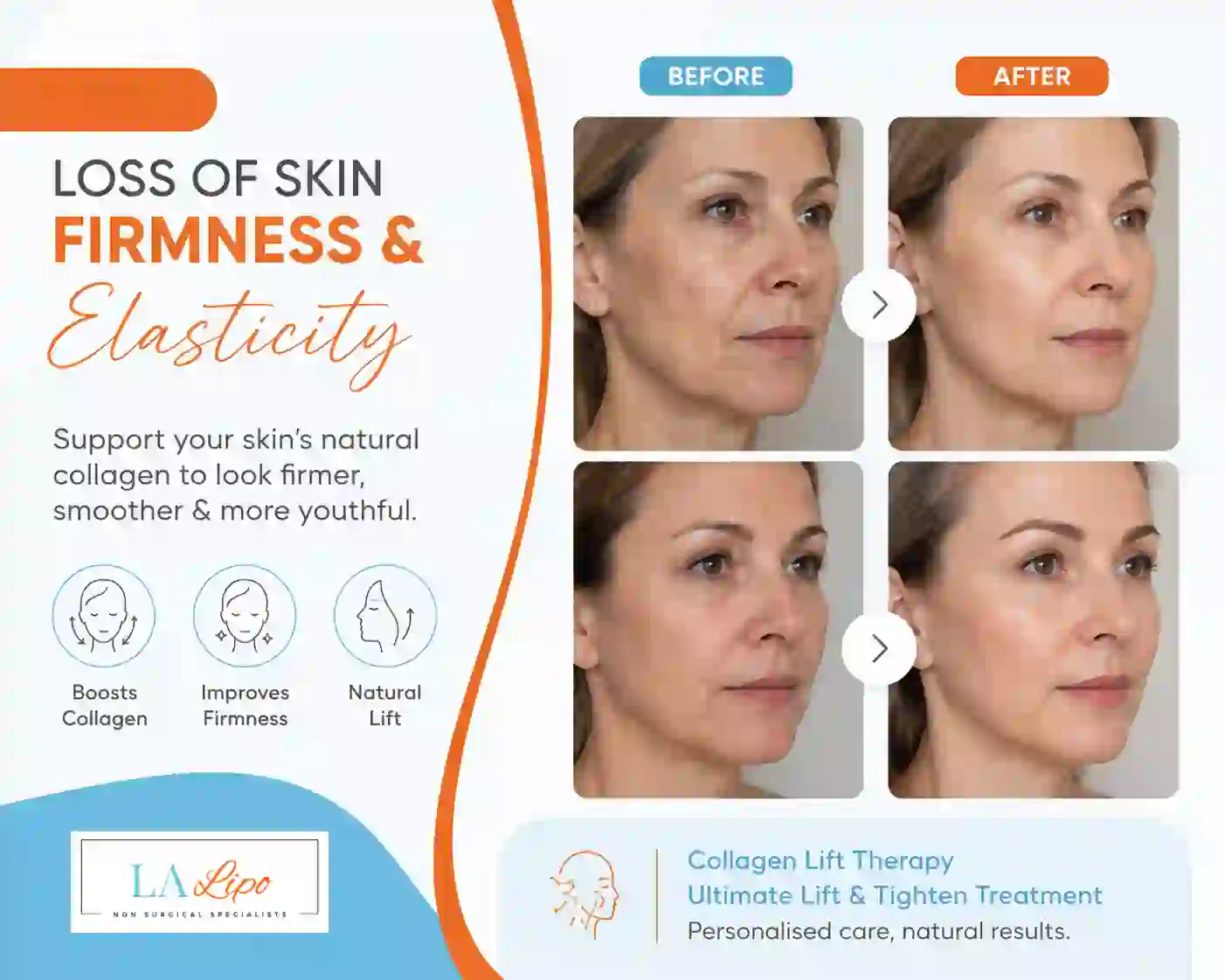 Sign #7: Loss of Skin Firmness and Elasticity Gloucester