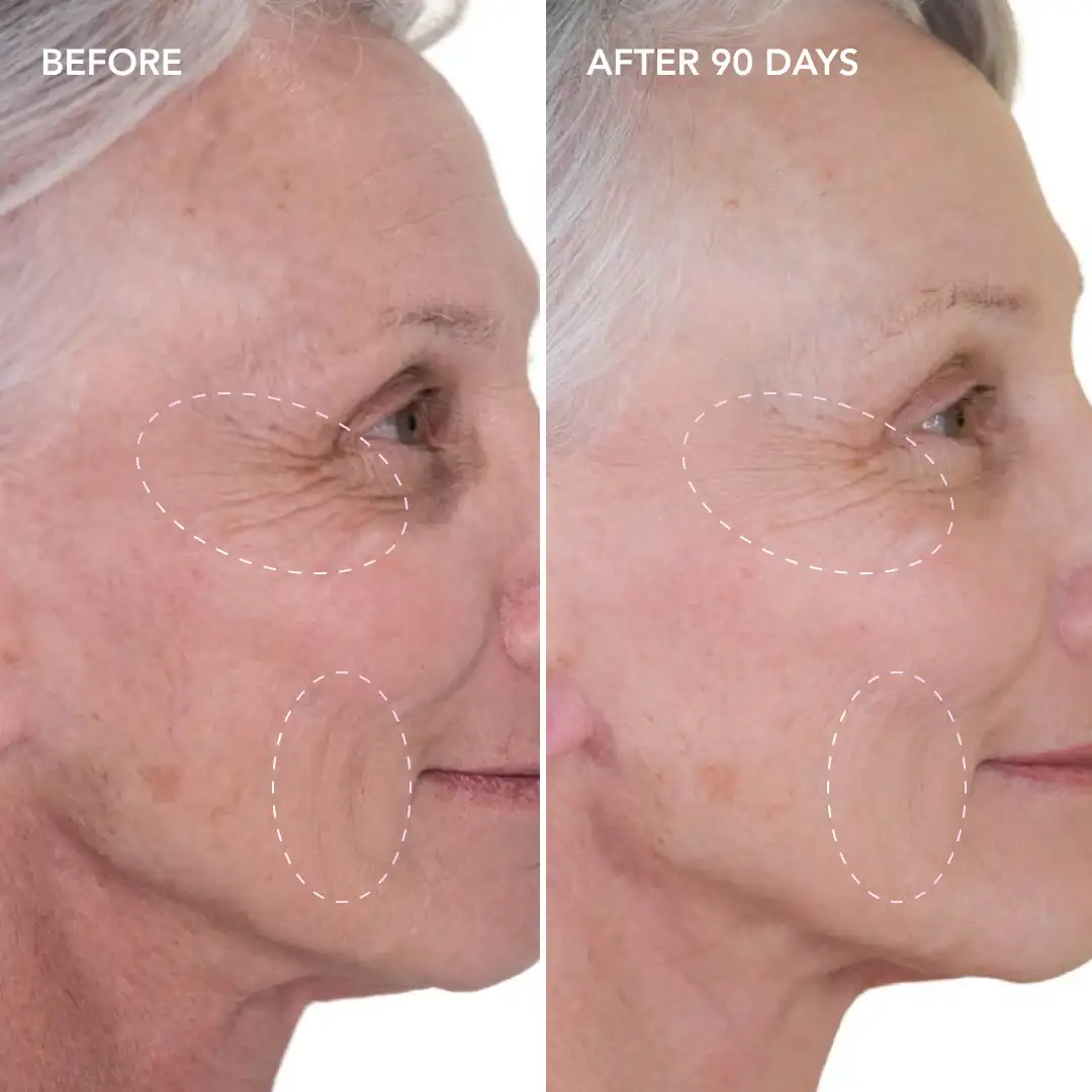 When will you see results Gloucester